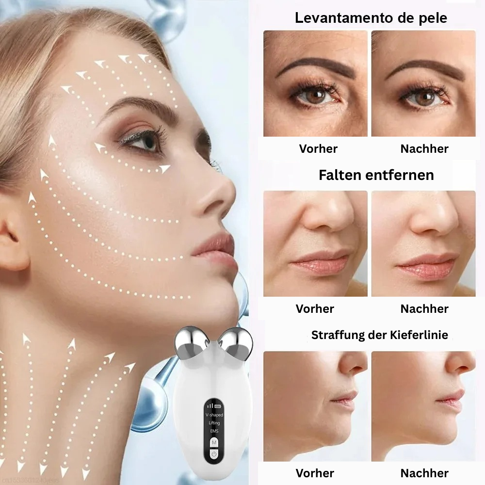 Gesichts Lifting Massagegerät