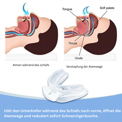 Anti-Schnarch-Gerät